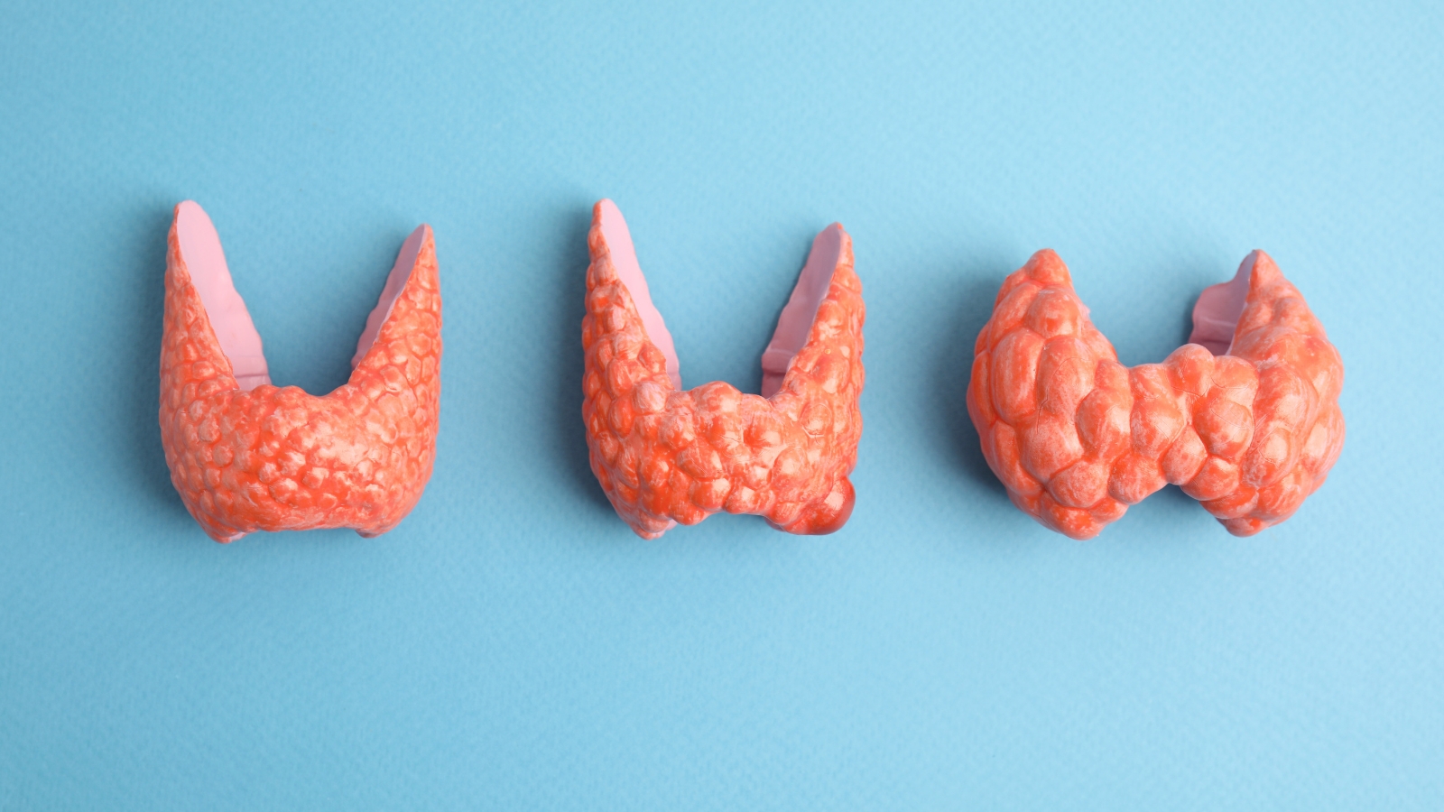 Cirugía de tiroides