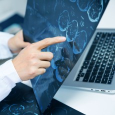 Resonancia magnética cerebral
