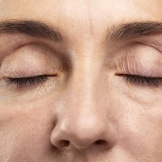 Cirugía de Blefaroplastia Superior (Párpados Caídos)