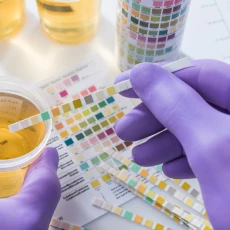 Test de Detección de 4 Drogas en Orina (Cannabis, cocaína, anfetaminas y opiáceos)