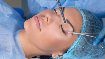 Blefaroplastia: Duración, Precio y Paso a paso