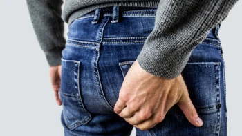 Fístula perianal, síntomas, causas, diagnóstico y tratamiento