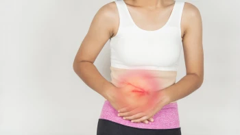 ¿Cómo se repara una Hernia Umbilical?