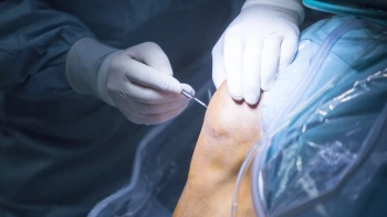 Tipos de artroscopia de rodilla