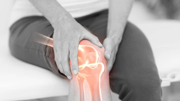Meniscopatía, qué es, causas y tratamiento