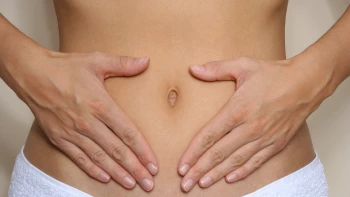 Tratamiento de miomas uterinos