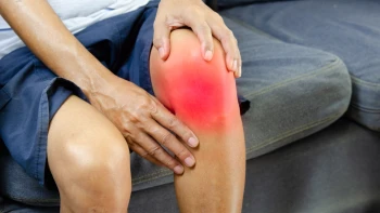 Gonartrosis de rodilla, qué es, causas, síntomas y tratamiento