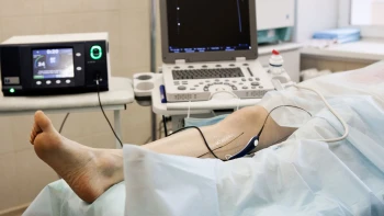 Cirugía de varices con láser: Duración, Precio y Paso a paso