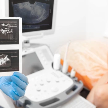 Tipos de cirugías de extracción de matriz