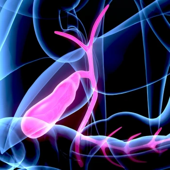 Postoperatorio de la operación de extracción de vesícula por laparoscopia