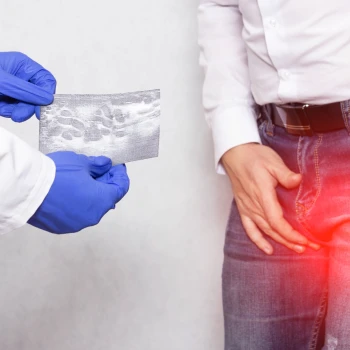Ecografía Testicular