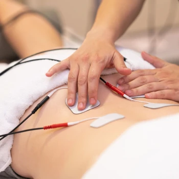 Test de Estimulación Repetitiva