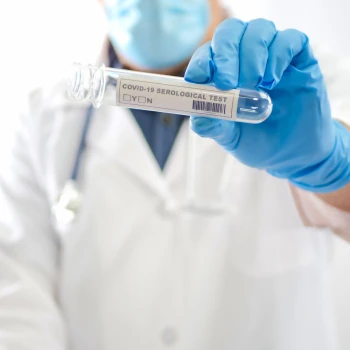 Test Serológico (Coronavirus)