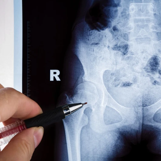 Radiografía de pelvis (4 proyecciones)
