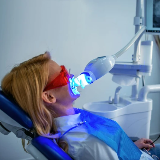 Blanqueamiento dental por fotoactivación (ambas arcadas)