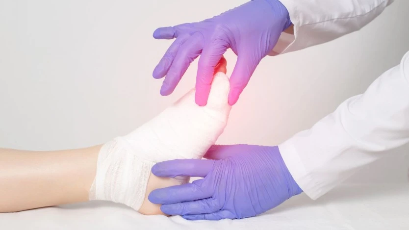 Cirugía de hallux valgus