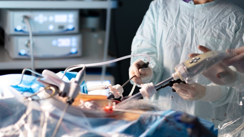 Imagen de un cirujano operando por técnica laparoscópica
