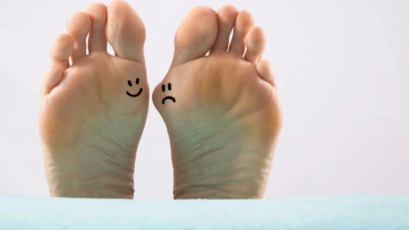 Síntomas de los hallux valgus