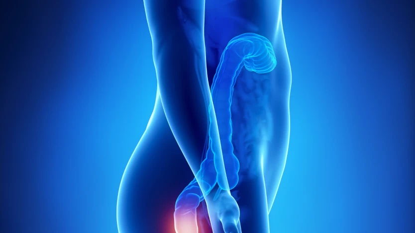 Lesiones anales