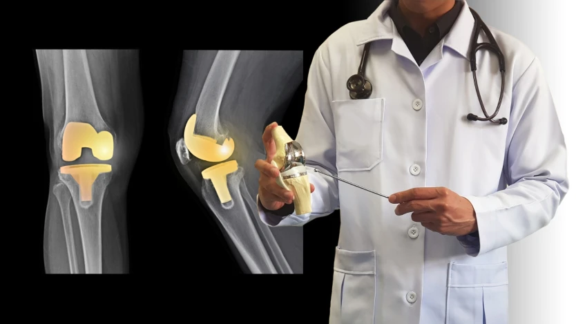 prótesis de rodilla