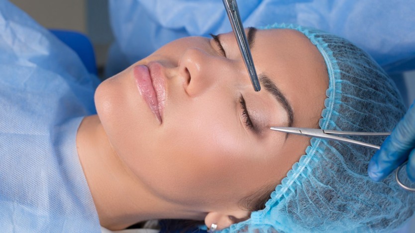 Blefaroplastia: Duración, Precio y Paso a paso