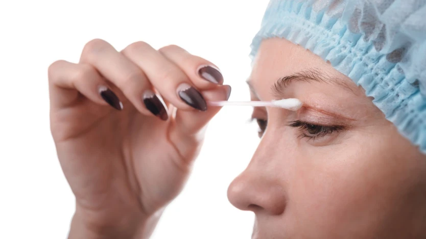 Tiempo de Recuperación tras una Blefaroplastia
