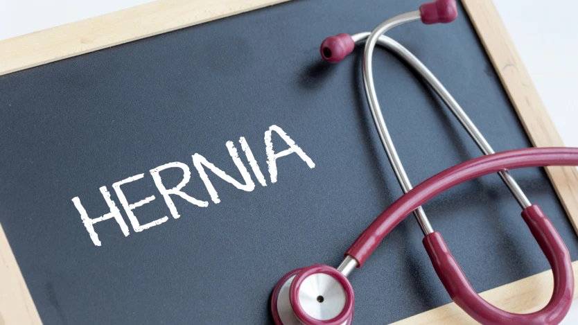 Hernia inguinal: Qué es, Causas, Tipos, Síntomas y Tratamiento