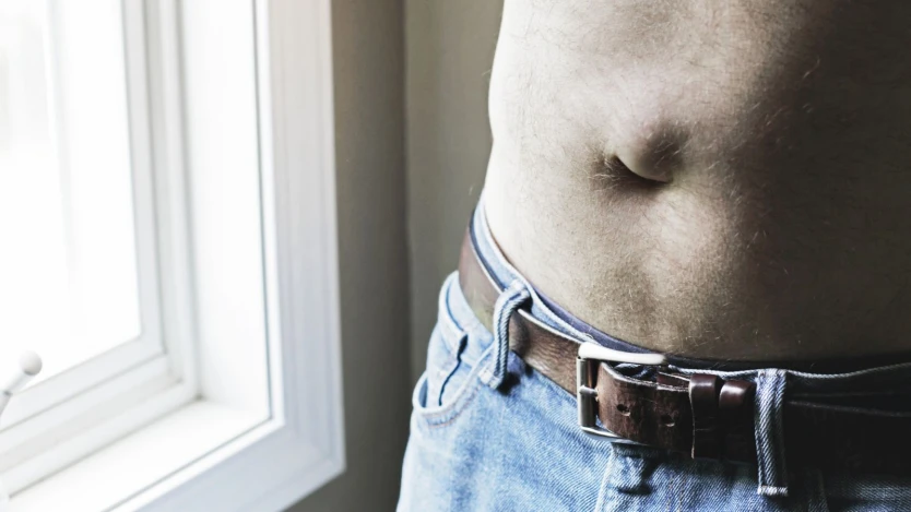 Hernia de ombligo en Adultos: ¿Hay que operar?