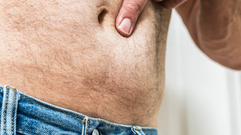 Hernia abdominal, qué es, tipos, cirugía y postoperatorio