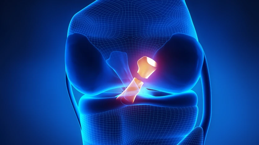 Rotura de ligamentos de la rodilla, ¿qué opciones tengo?