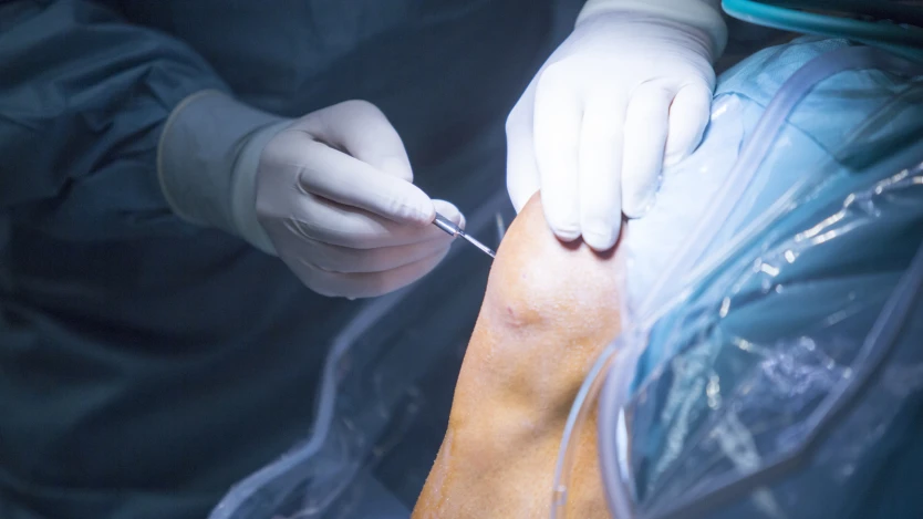 Tipos de artroscopia de rodilla