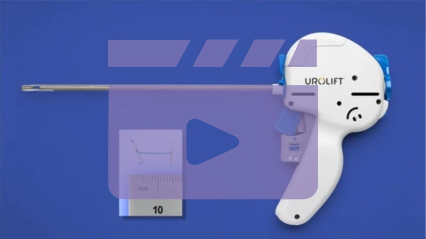 [Vídeo] Operación de Próstata ambulatoria con Sistema Urolift, ¿Qué debes saber?