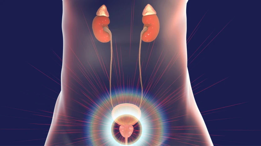 Hipertrofia prostática, causas, síntomas, diagnóstico y tratamiento