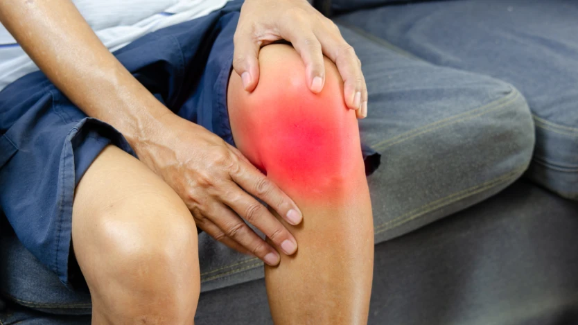 Gonartrosis de rodilla, qué es, causas, síntomas y tratamiento